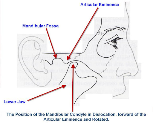 Poor Blood Circulation in R-Lower Jaw
