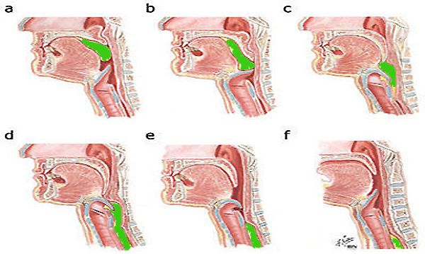 Swallowing Problem